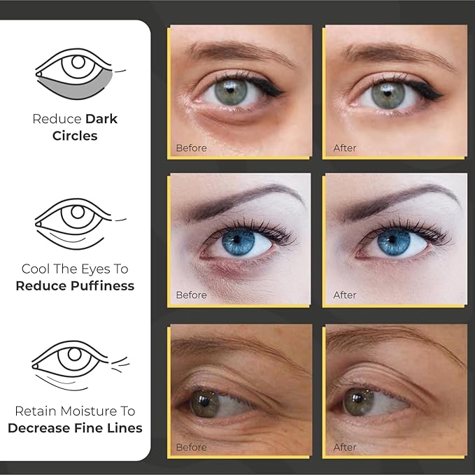 Under Eye Patches for Puffy Eyes and Dark Circles | Infused Gel Mask Patches for Dark Circle Undereye Support of Bags & Puffiness | Ideal for Bridesmaid Gifts & Bachelorette Party | Day and Night
