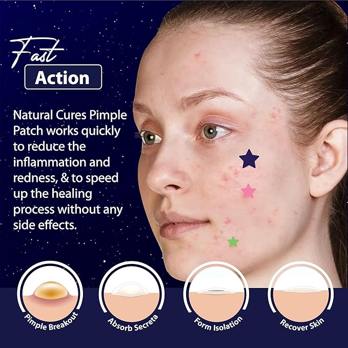 Star Pimple Patches for Face β Hydrocolloid Acne Patches for Quick Zit Relief and Blemishes, Invisible Spot Stickers That Stay All Night, Gentle for All Skin Types, Oil-Free (240 Count)