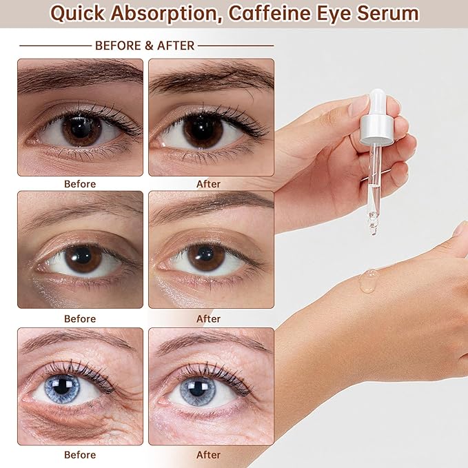 The Caffeine Solution 5% + EGCG,Reduces Appearance of Eye Contour Pigmentation and Puffiness,Under Eye Serum (30ml) Caffeine For Face Moisturizing Serum (1)