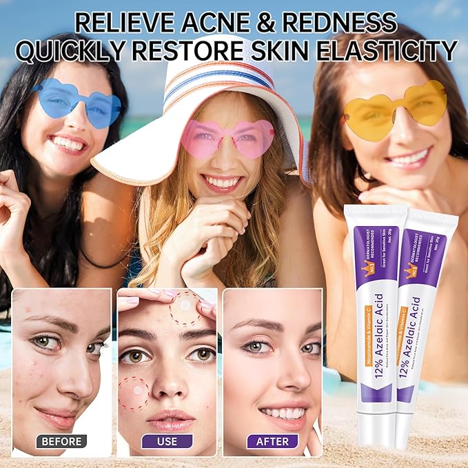 Azelaic Acid 12% Cream For Face, Azelaic Acid Acne Cream For Rosacea Treatment, Redness Relief, 2PCS Azelaic Acid Serum With Salicylic Acid & Niacinamide For Dark Spot, Skin Care.