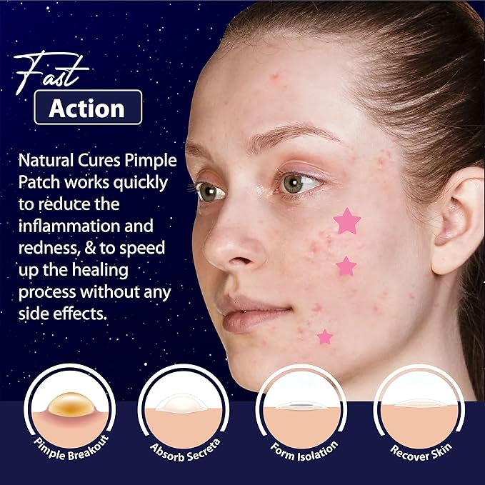 Star Pimple Patches for Face β Hydrocolloid Acne Patches for Quick Zit Relief And Blemishes, Invisible Spot Stickers That Stay All Night, Gentle for All Skin Types, Oil-Free (40 Count)
