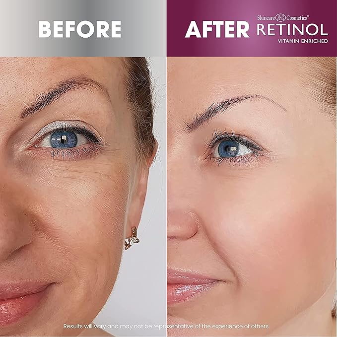 Retinol Anti-Aging Facial Oil – With Nine Essential Oils, Restores Hydration and Nourishment Skin Brightener – Skin Tone Corrector Smooths & Rejuvenates Face for a Healthy Glow.