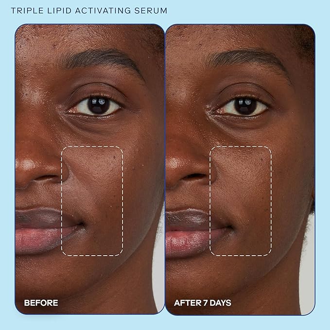 Skinfix Barrier+ Triple Lipid Activating Serum: Featuring Patented* Anti-Aging B-L3™ Complex and 10 Potent Active Ingredients for Firmer, Plumper, and Smoother Skin, 1 oz