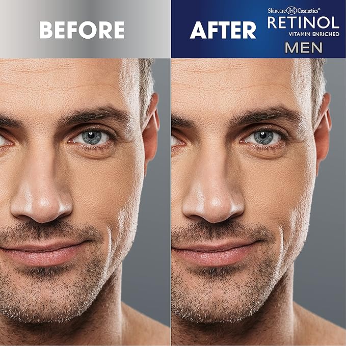 Retinol Men’s Eye Cream – The Original Retinol Eye Treatment For Men – Targets Under-Eye Area to Reduce Puffiness & Dark Circles, Boost Hydration & Drastically Minimize the Visible Signs Of Aging