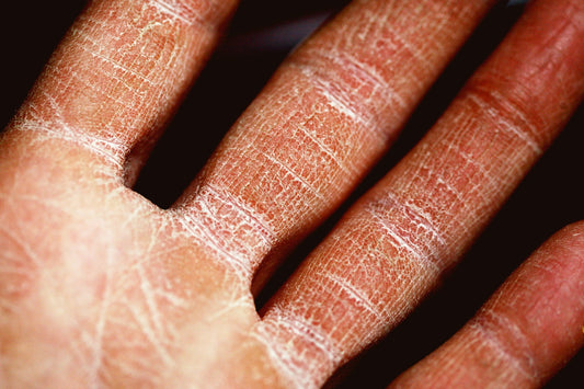 SPF 50 Daily Sunscreen: Protect Your Skin Every Day
