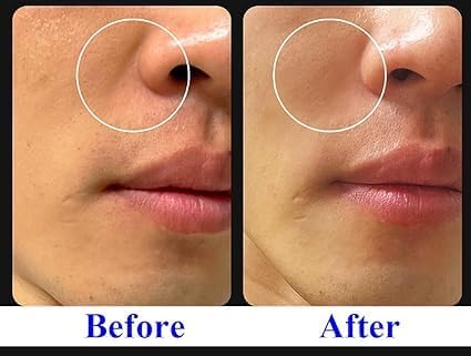 Exceptional Regenerating Serum: Lifts, Volumizes, and Revitalizes with SCM, 5% Volufiline, T1 Collagen, and PHA (30ml, 1oz)