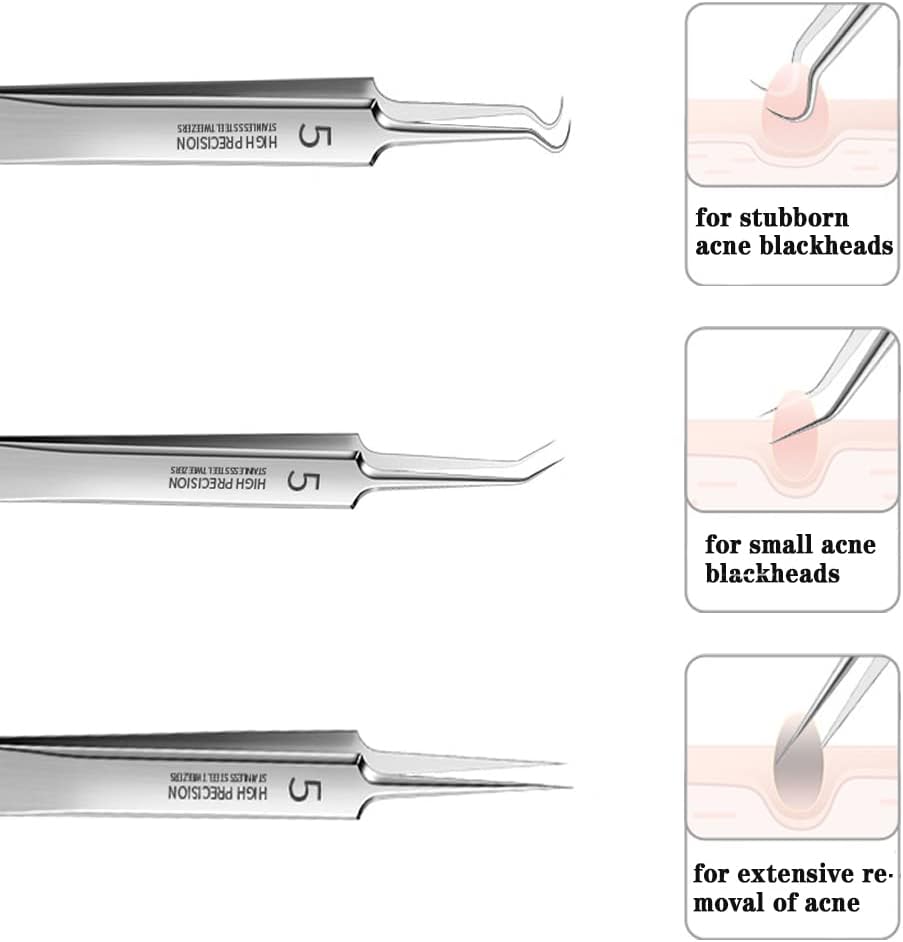 Professional Facial Blackhead Remover Tweezers,3Pcs Precision Pimple Popper Tool Kit for Whitehead Ance Blemishs Comedones Stainless Steel Makeup Tool - Glossy