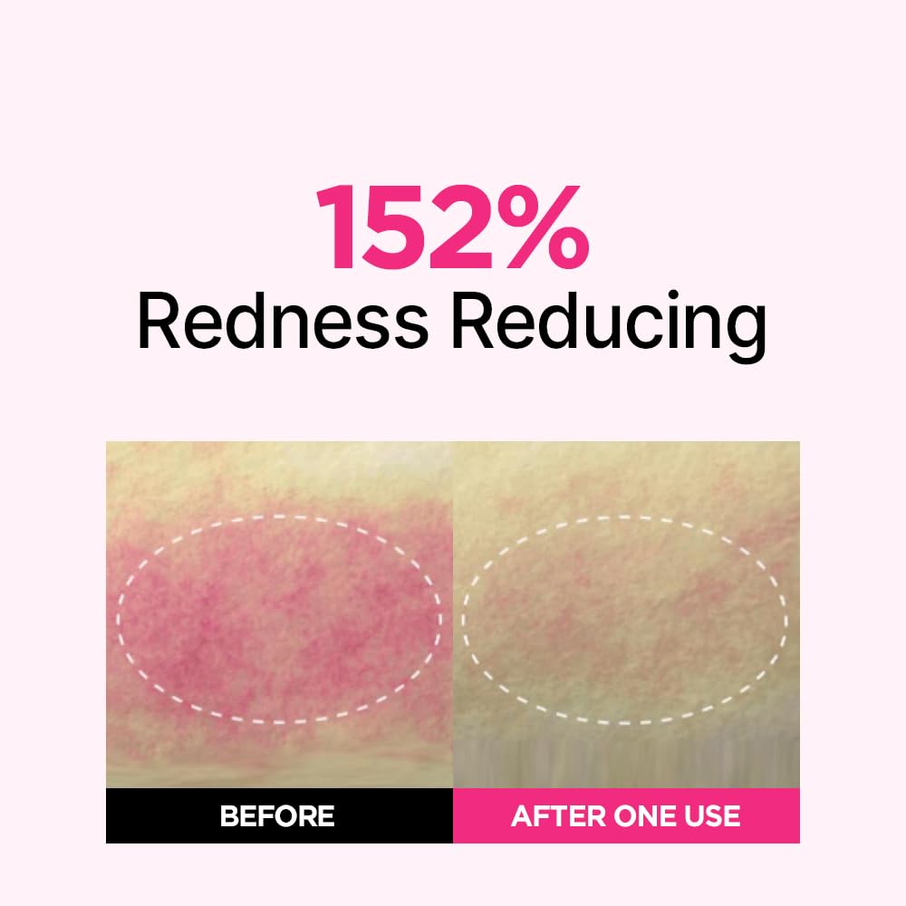 ISOI Blemish Care Up Facial Serum Triple Set, Korean Skin Care Set for Glass Skin Radiance, 2 Full Size & 1 Refill, Eye & Wrinkle Patch Tester, Daily Hydration Skincare Gift for Women (2.13 fl. oz)