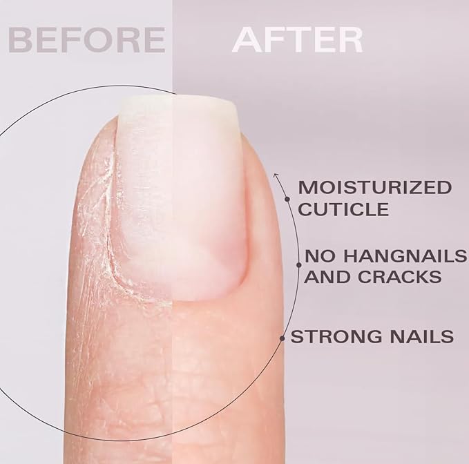 Nail Oil Cuticle Pen - Fragrance Free - Nail Strengthener & Growth Serum with Vitamin A, D, E, B5, Grapeseed & Natural Oils - Repair for Brittle, Peeling, Thin Nails (No Scent)