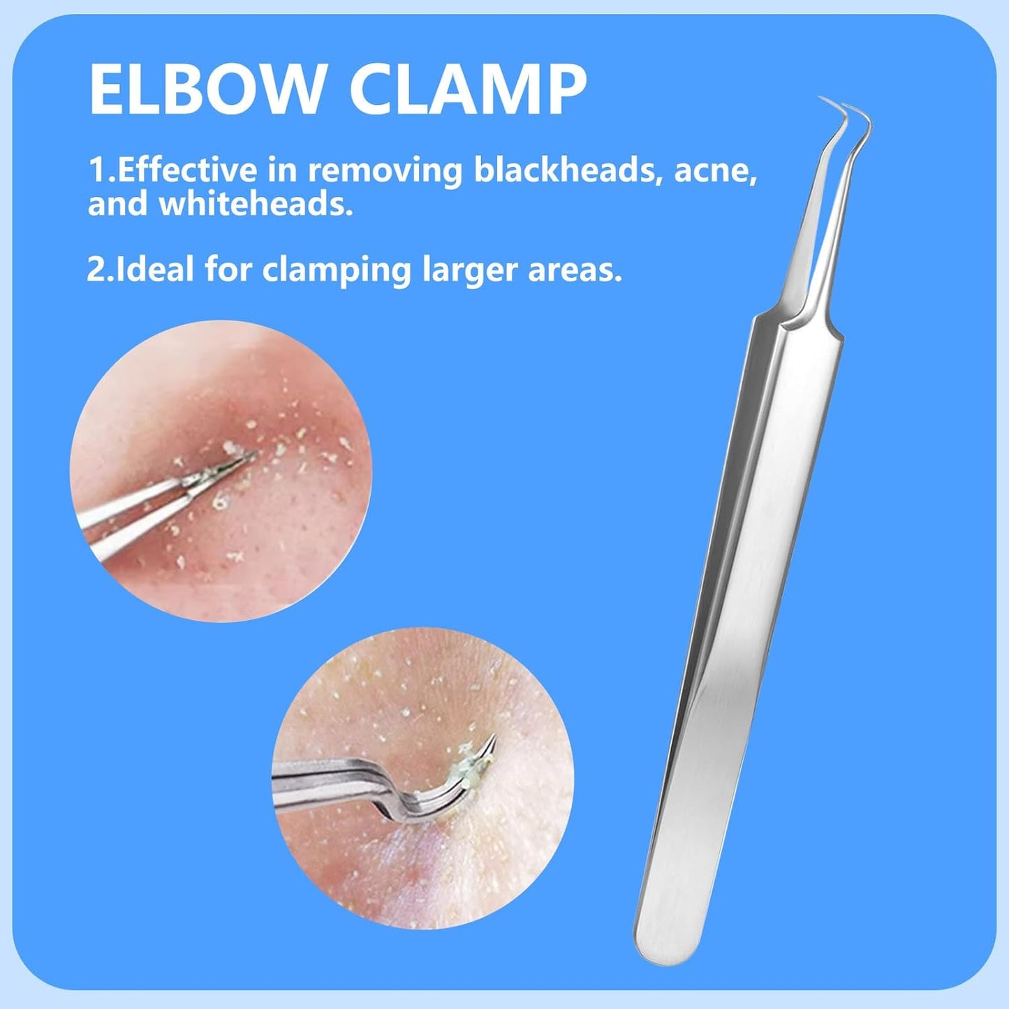 5PCS Blackhead Remover Comedone Extractor Kit - Professional Stainless Steel Tools for Pimple, Acne, and Blemish Removal - Curved Tweezers Included