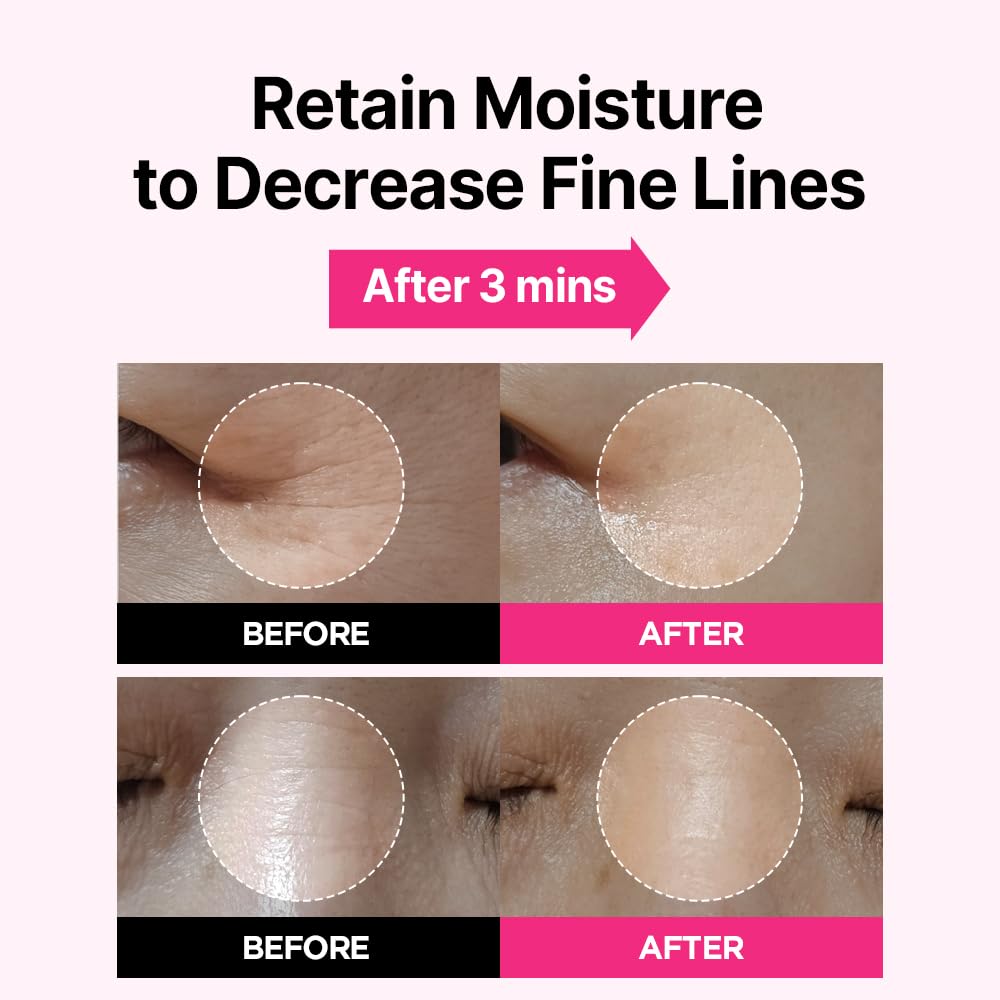 ISOI Blemish Care Under Eye Patch for Dark Circles, Puffiness and Wrinkles, Hydrating Gel Eye Masks with Hyaluronic Acid & Bulgarian Rose Oil, Korean Skin Care (90 pcs, 3.17 oz)