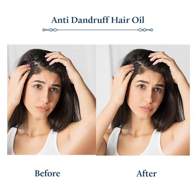Blue Nectar Tea Tree Oil for Hair | Natural Anti Dandruff Oil for Scalp | Ayurvedic Plant Based Neem Amla Hair Oil (12 Herbs, 3.38 Fl Oz)