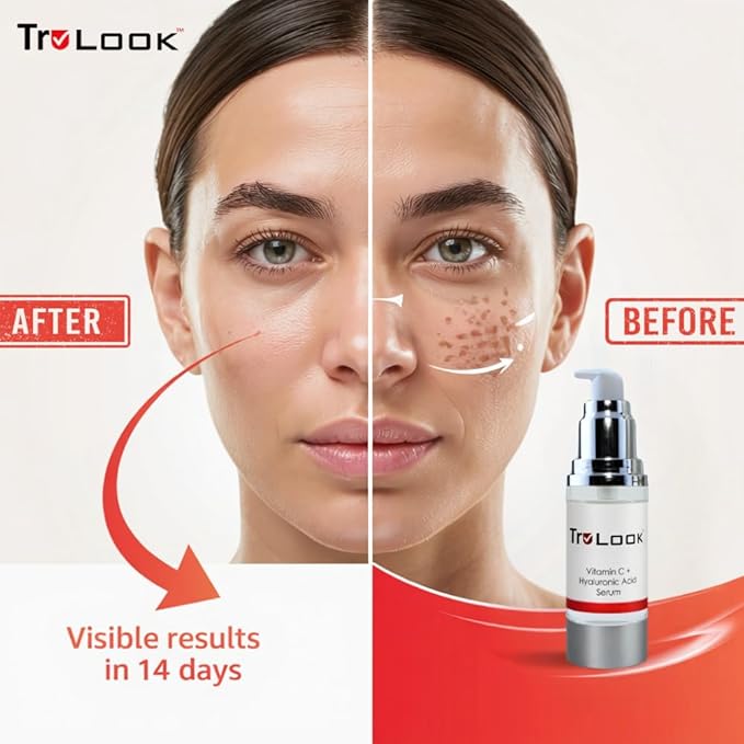 Vitamin C + hyaluronic Acid Serum, Anti Aging, Anti Wrinkle, Improves Dark Spots, Tone, & Fine Lines Made is USA