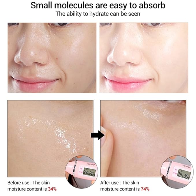 AICHUN BEAUTY Face Serum Eye Essence Anti-Wrinkles Anti-Acne Oil-Control Anti-Freckle Refreshing Moisturizing Purifying Shrink Pores 30ml 1.01FL.oz (10% Alpha Arbutin + 5% Mandelic ACID Face Serum)