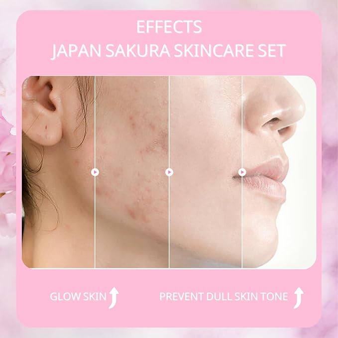 Sakura Skin Care Set, Women Gift Sets, Skin Care Kit with Cleanser, Toner, Serum, Eye Cream, Face Cream and 2Pcs Sleep Mask, Skin Care Routine Kit for Women, Even Skin Tone, Skin Care Sets & Kits