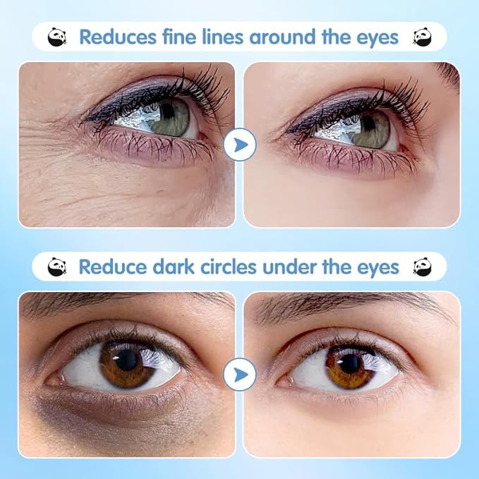 Under Eye Patches for Dark Circles, Puffy Eyes & Wrinkles - 60 Pairs Hydrating Eye Mask with Hyaluronic Acid, Blueberry Extract - Vegan, Cruelty-Free