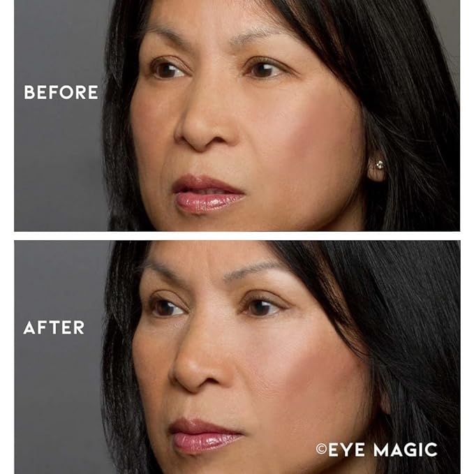 Premium Eyelid Lift (L/XL Kit + Gel) Made in the USA. Lifts and Defines Droopy, Sagging or Hooded Eyes Safe for Daily Use