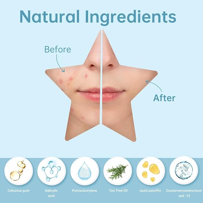 200 Counts Star PimPle Patches for Face, Hydrocolloid Acne Pimple Patch with Tea Tree Oil for Party Gift Covering Zits Blemishes