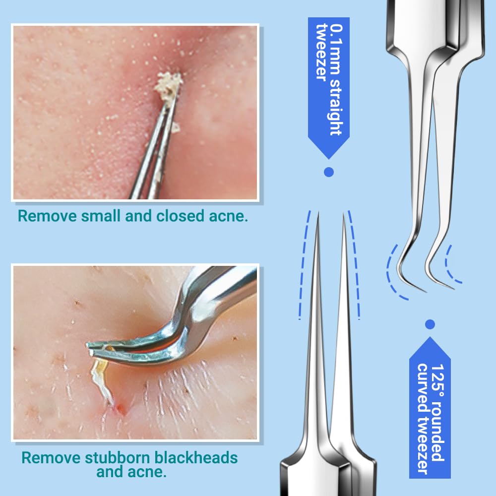 TsMADDTs Blackhead Remover Pimple Extractor Acne Treatment Tool, Comedones Removal Kit for Blemish, Whitehead, 8 Pcs Pimple Popper Tool Kit for Facial and Nose