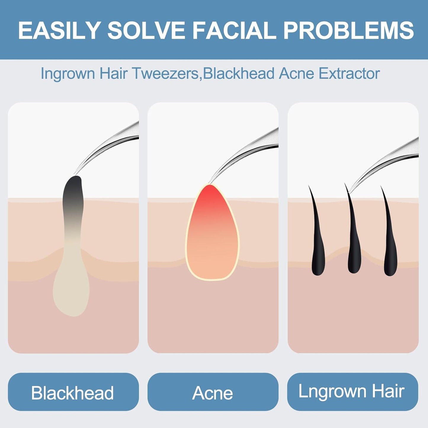 60PCS Dual Heads Blackhead Remover, Pimple Comedone Extractor, Acne Whitehead Blemish Removal Kit, Premium Stainless Steel Pimple Popper Tool kit, Risk Free for Face Skin, with Portable Box