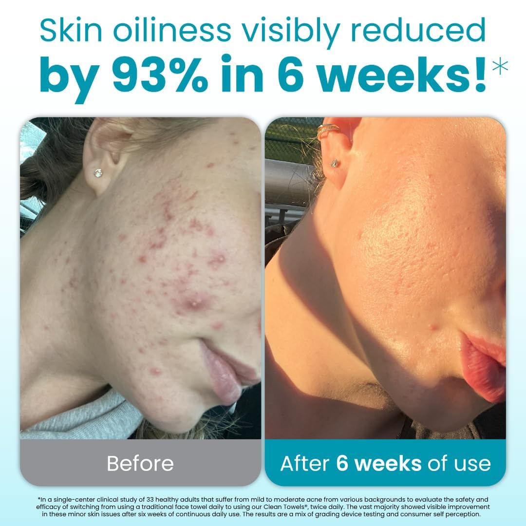 Clean Skin Club Blemish Control Clean Towels® XL, Compostable Face Towels, Light Exfoliation for Oily Skin, Eczema Association Accepted Disposable Face Towelette, Makeup Remover Dry Wipes, 50 count