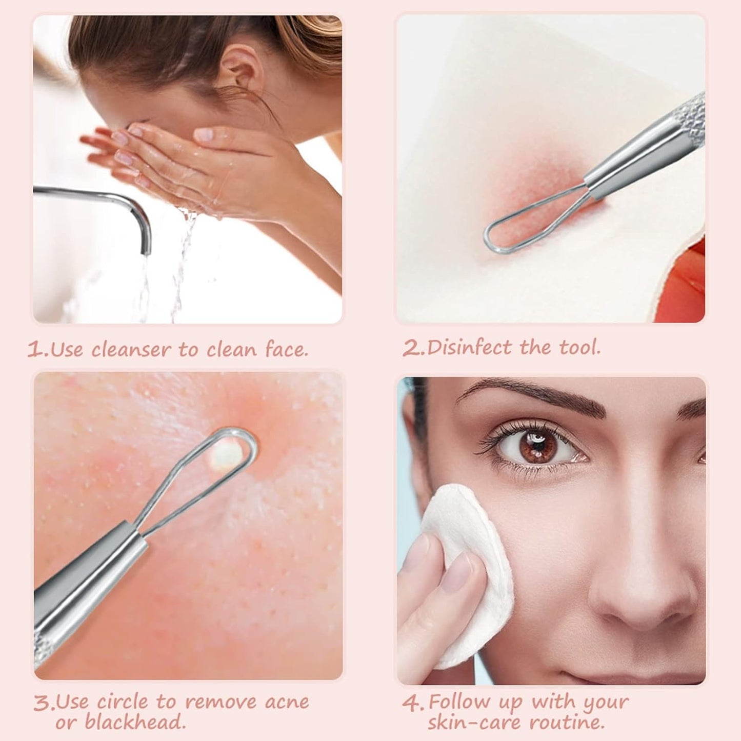 Professional Blackhead Remover Blemish Extractor Tool - Pimple Comedone Removal 2-in-1 Stainless Steel Pimple Popper(2pcs)