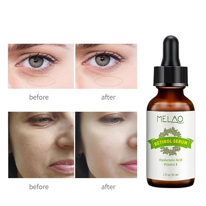 Retinol Serum in Squalane, High-Strength Anti-Aging & Skin Smoothing Formula for All Skin Types - 30ML Per Bottle
