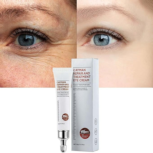 Magic Eye Cream, Instantly Remove Under Eye Bags Wrinkles Puffiness Dark Circles and Fine Lines, Anti Aging Eye Cream for Men Women