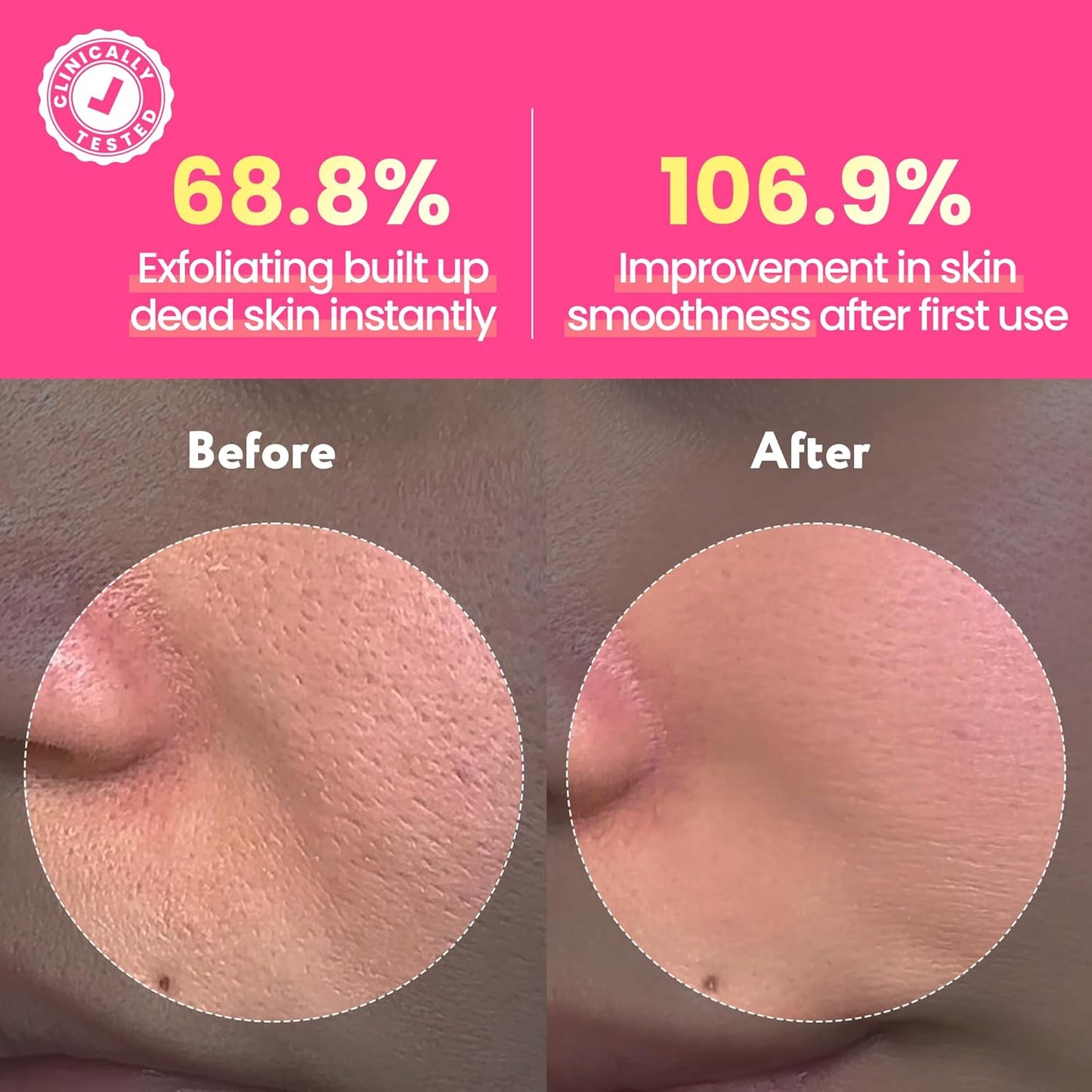 Coconut Jelly Pudding Cleanser | Deep Pore Cleansing & Gentle Exfoliation with Jelly-to-Foam Texture | Hydrating Face Wash with Panthenol, Ceramide & Peptides (100ml)