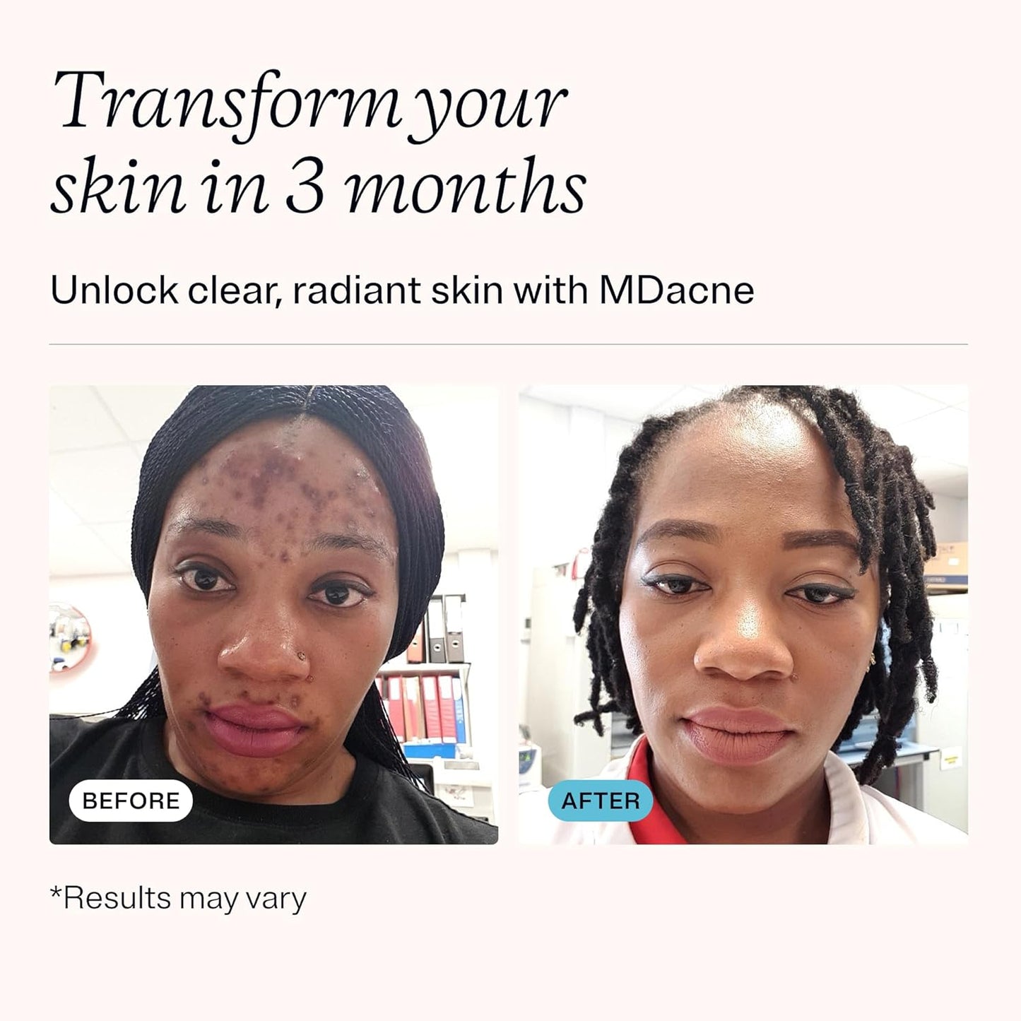 MDacne 3 Step Retinol Acne Kit - Retinol Cream 0.25%, Salicylic Acid Cleanser, Niacinamide Moisturizer - Plant-Based products for Hormonal Acne, Blemishes, and Wrinkles. 30 Day Complete Acne Care Kit