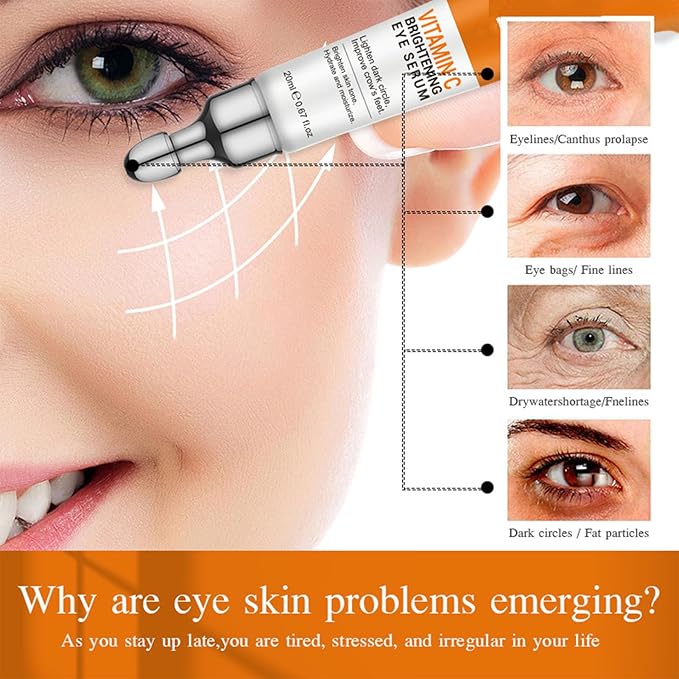 Vitamin C Eye Cream for Dark Circles, Fine Lines Puffiness Crow's Feet Eye Bags Under Eyes Treatment for Women & Men, Advanced Super C Serum With Hyaluronic Acid 1.34 oz (2)