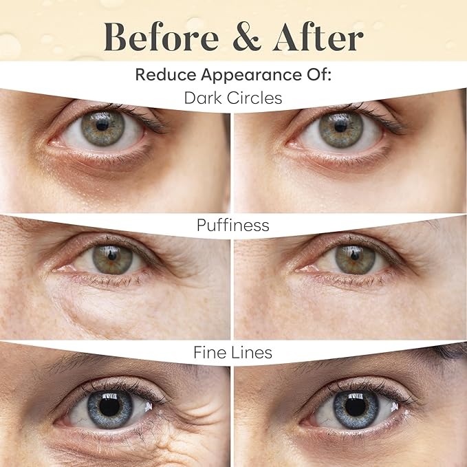 Vitamin C Under Eye Patches (30 Pairs), Under Eye Mask for Puffy Eyes, Appearance of Dark Circles, Smoothing & Hydration, Self Care & Skincare Gifts for Women, Patch Yeux
