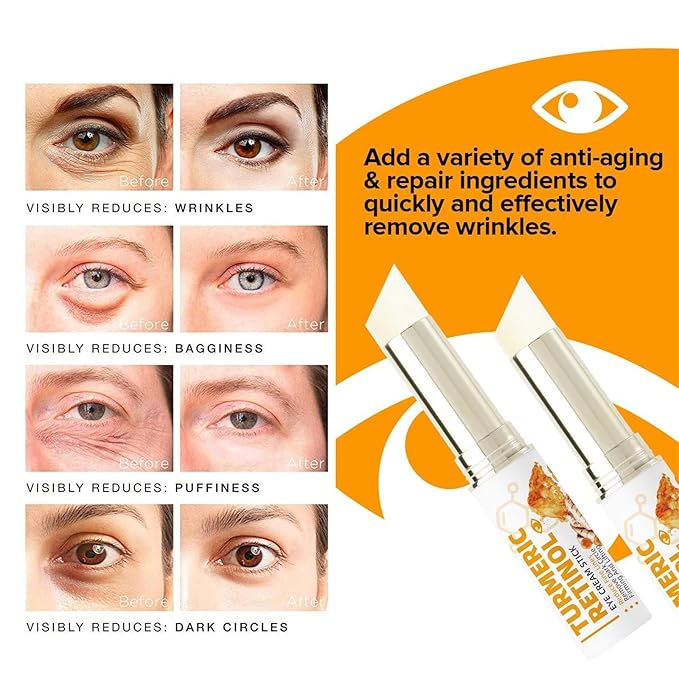 Lumibalm for Under Eye Bags, Turmeric Retinol Eye Cream Stick, Retinol Eye Cream Stick for Dark Circles, Wrinkles, Anti-Aging and Puffiness