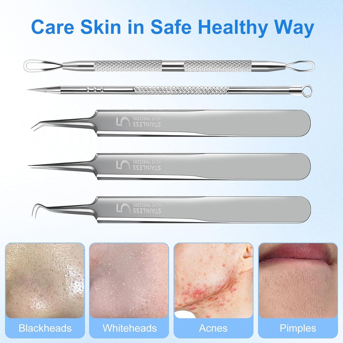 Blackhead Remover Tweezers, Pimple Popper Tool Kit, Ingrown Hair Tweezers, Blackhead Extractor, Skin Zit Acne Blemish Popping Removing Surgical Tweezers Tools for Nose Eye Face