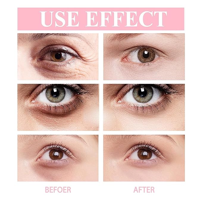 3PCS Retinol Eye Cream Stick, Hydrating Eye Balm, Retinol Eye Cream for Dark Circles and Puffiness, Eye Serum Balm Skin Care