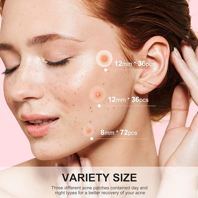 AVJONE Pimple Patches for Face(144 Patches), Hydrocolloid Acne Patches with Tea Tree Oil, pimple stickers for Breakouts, Absorbs Zit, Invisible Spot Cover and Blemish 2 Sizes| Vegan, Cruelty-free