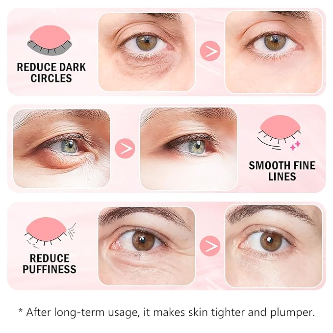 Under Eye Patches (30 Pairs) 24K Gold Eye Mask and Hyaluronic Acid Eye Patches for Puffy Eyes, Rose Eye Masks for Dark Circles, Puffiness, Eyebag, Wrinkles - Gift for Women