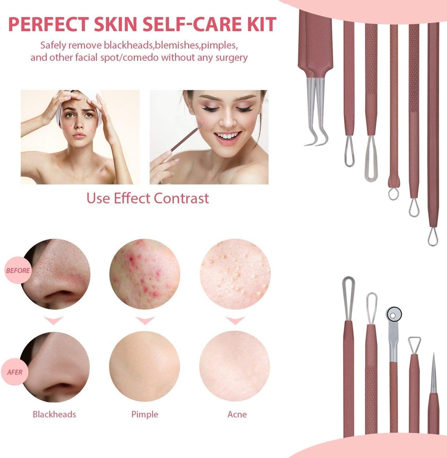 JPNK Blackhead Remover Tool Comedones Extractor Acne Removal Kit for Blemish, Whitehead Popping, 6 Pcs Zit Removing for Nose Face Tools with a Leather Bag (Pink)
