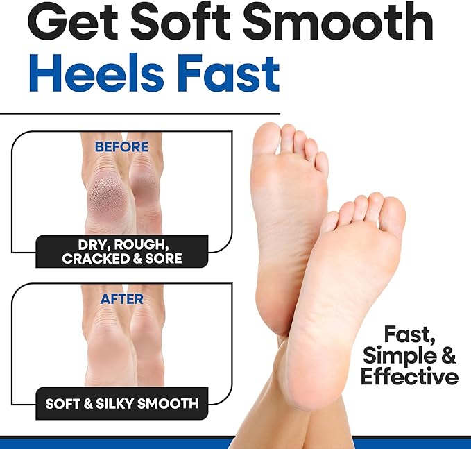 Moisturizing Socks for Men & Women | Cracked Heel Treatment with Aloe Vera | Moisturizer Heel Callus Remover | Aloe Socks for Cracked Heels & Dry Feet | Lotion Gel Sleeves (X-Large - Black)
