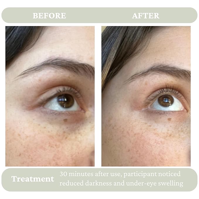 Cucumber Eye Serum - Hydrating Under Eye Serum for Dark Circles & Puffiness - Eye Tightening & Uplifting Anti Aging Serum for Women - Facial Moisturizer for Women Anti Aging