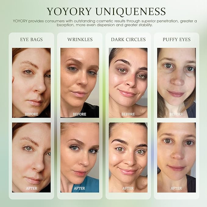 Under Eye Patches Masks - for Puffy Eyes, Dark Circles,and Fine Lines,Eye bags,Reduce Wrinkles Smoothing Skin Care Treatment with Collagen and Hyaluronic Acid for Women and Men, (60 Pcs) Green