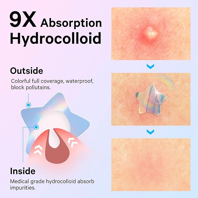 Sosky Hologram Pimple Patches for Face, Hydrocolloid Acne Patches with Salicylic Acid, Cute Star Zit Stickers,Colorful Blemish Covers,36 Count Blue Pink Star Heart Moon