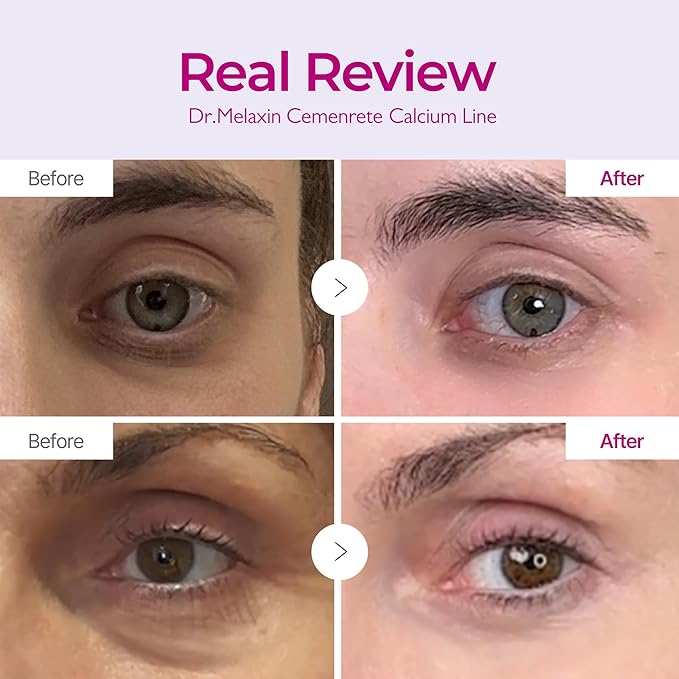 CEMENRETE EYE CREAM