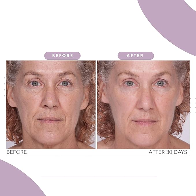 Serious Skincare Reverse Lift Firming Face Serum for Skin Tightening - Hydrating Anti-Aging Peptides - Lift & Firm Skin Care for Sagging Facial & Neck Contours - 1 Fl. Oz.