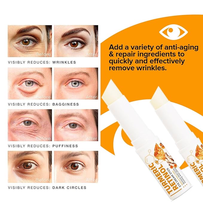 2 PCS Turmeric Retinol Eye Stick,Eye Balm Stick Hydrating for Dark Circle,Wrinkles,Visible Results in 3-4 Weeks,Anti Aging Under Eye,Retinol Eye Cream For Puffiness and Bags Reduces Fine Lines