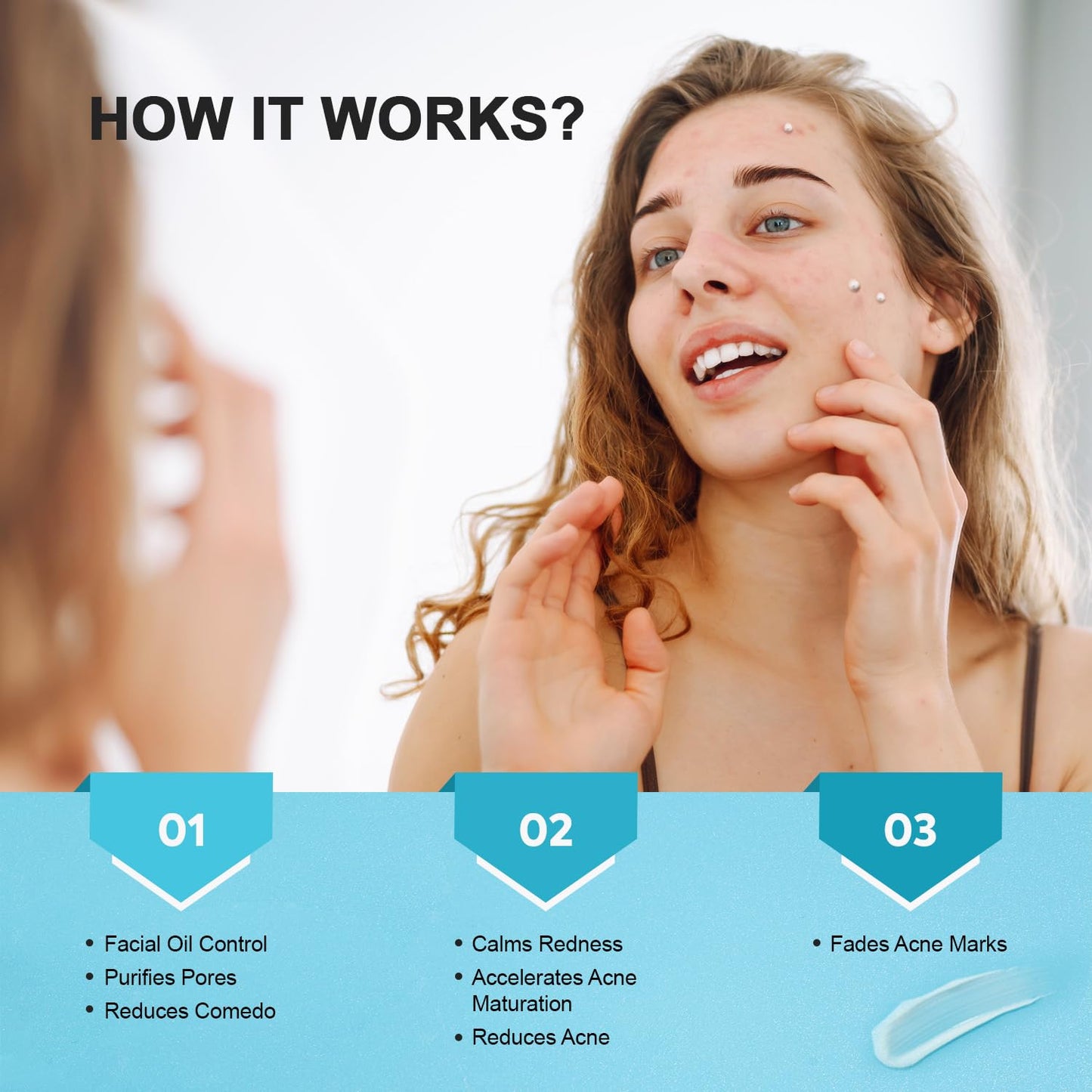 Acne Pimple Spot Treatment Cream: Cystic Hormonal Blackheads Blemish Remover for Face, Back and Body - with 10% Azelaic Acid - Teens 13-19 & Young Adult 20-30, 1.8 oz