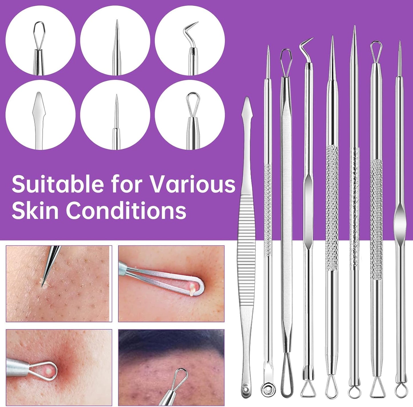 15 PCS Pimple Popper Tool Kit,Blackhead Remover Comedone Extractor Tools,Professional Pimple Comedone Extractor,Stainless Steel Skin Blemish Removal Acne Tools for Forehead Nose Face with Metal Case