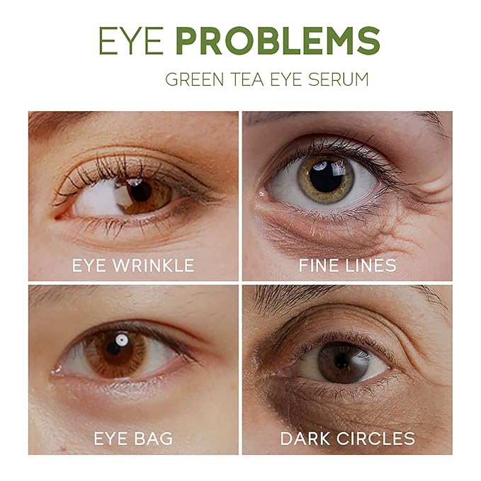 AKARY Green Tea Eye Serum and Under Eye Roller Cream, for Eye Bags Puffiness, Caffeine Eye Cream with 360° Massage Ball Reduce Wrinkles and Fine Lines, Under Eyes, Moisturizing, Hydrating, Firming Eye Skin (Green Tea)