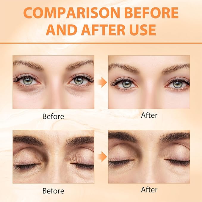 Revive + Glow Vitamin C Eye Balm (0.14 oz),Moisturizing & Hydrating Eye Cream, Brightening and Reducing Dark Circle, Firming Eye Cream (2 PCS)