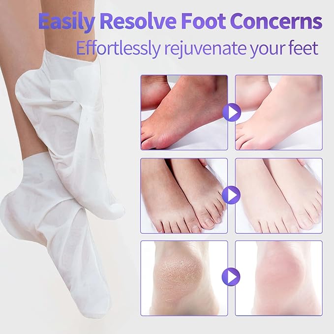 Moisturizing Foot Mask 5 Pack,Hydrating Foot Masks for Dry Cracked Feet,Moisturizing Socks Dry Skin Moisturizer for Soft and Smooth Touch Feet,Foot Care Spa Gifts for Women Men Mother's Day Gifts